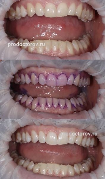 Милютина Ирина Андреевна, стоматолог-гигиенист - 5 отзывов | Томск ...