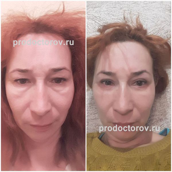 Пластическая операция уфа. Пластическая операция уфа. Пластическая операция уфа. Пластическая операция уфа. Пластическая операция уфа.