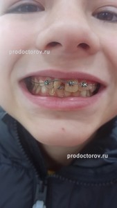 /